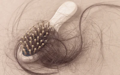 Caiguda capil·lar: per què el cabell perd densitat